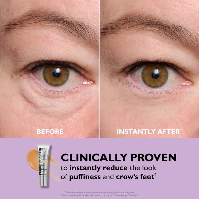Instant Youthful Eyes - Non-Invasive Eye Tightening Treatment