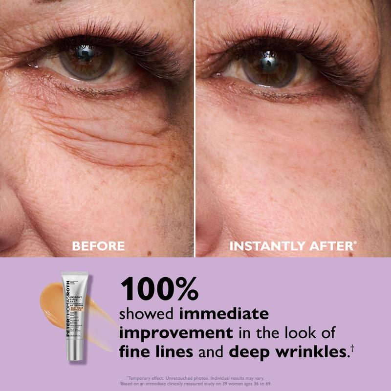 Instant Youthful Eyes - Non-Invasive Eye Tightening Treatment