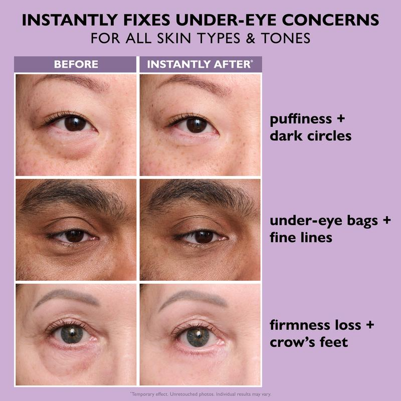 Instant Youthful Eyes - Non-Invasive Eye Tightening Treatment