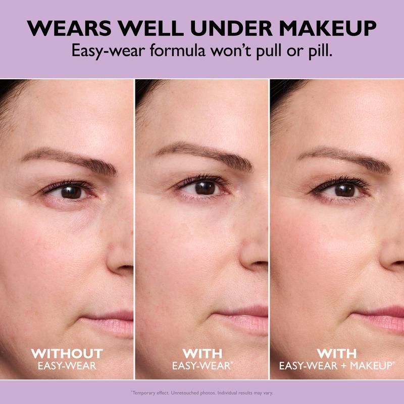 Instant Youthful Eyes - Non-Invasive Eye Tightening Treatment