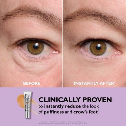 Instant Youthful Eyes - Non-Invasive Eye Tightening Treatment