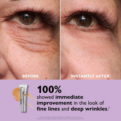 Instant Youthful Eyes - Non-Invasive Eye Tightening Treatment