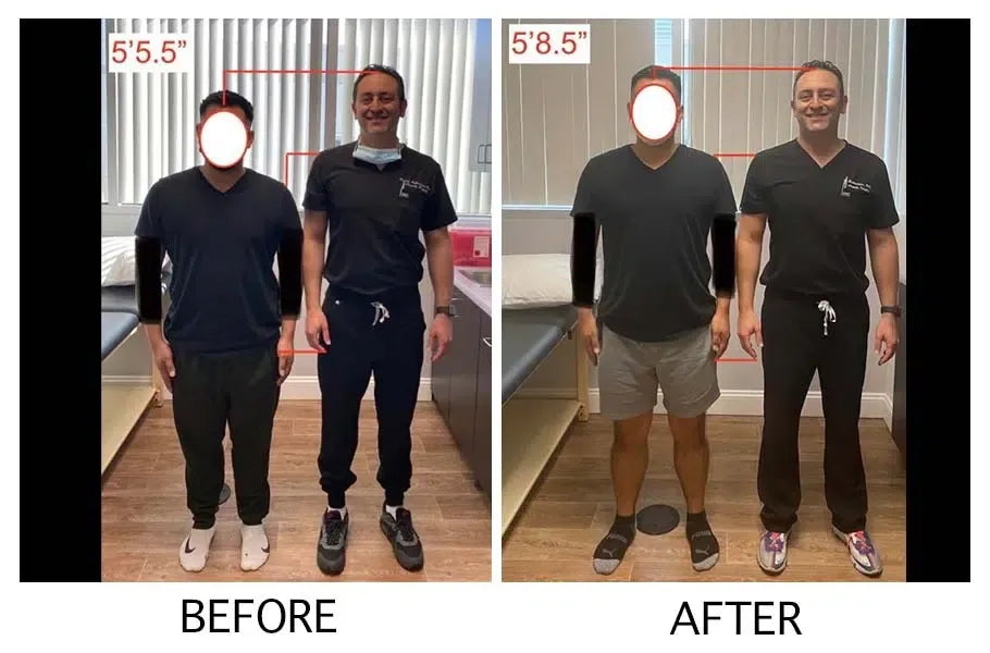Unlock Your Full Potential - Heightener Gummies for a Taller, More Confident You!