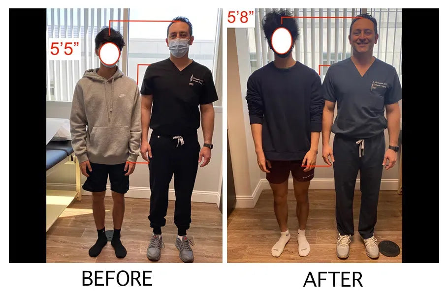 Unlock Your Full Potential - Heightener Gummies for a Taller, More Confident You!