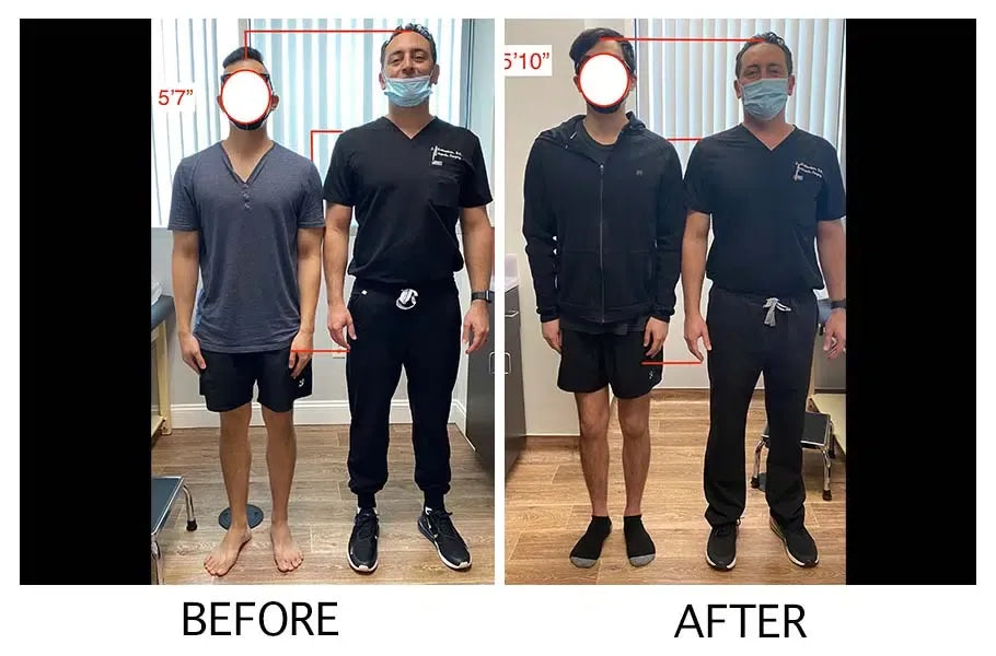 Unlock Your Full Potential - Heightener Gummies for a Taller, More Confident You!