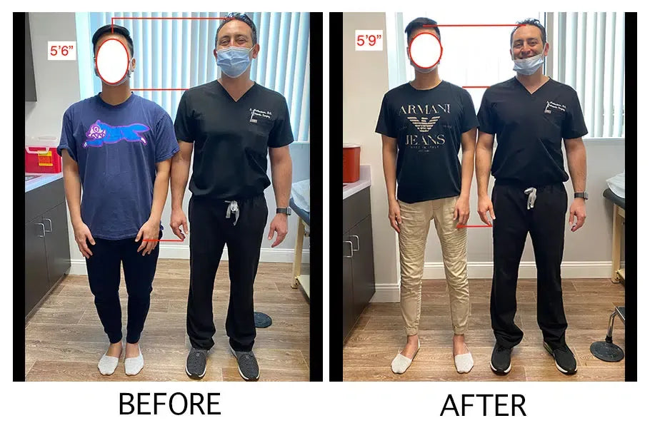 Unlock Your Full Potential - Heightener Gummies for a Taller, More Confident You!